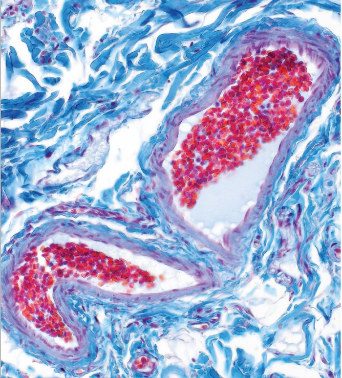Fargekamera